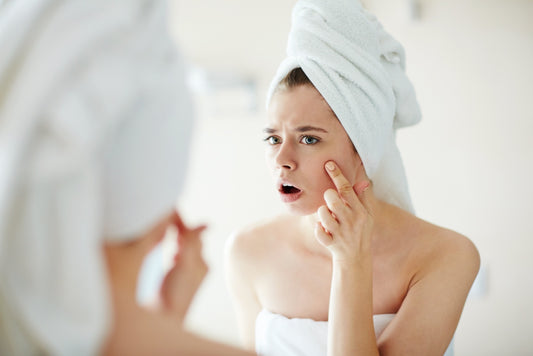 6 REASONS WHY YOUR MAKEUP COULD BE CAUSING ACNE