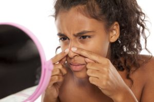 TREAT YOUR ACNE THE NATURAL WAY