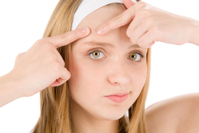 ACNE: WHAT CAUSES IT AND WHAT CAN I DO ABOUT IT?